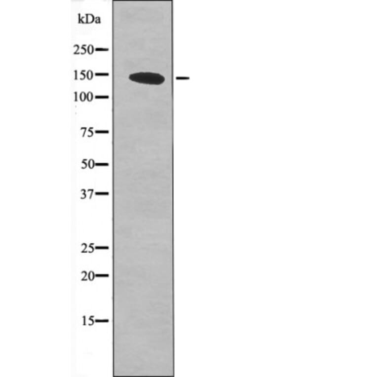 Western blot - PDGFR α (Phospho-Tyr762) Antibody from Signalway Antibody (12431) - Antibodies.com