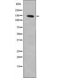 Western blot - PDGFR α (Phospho-Tyr762) Antibody from Signalway Antibody (12431) - Antibodies.com