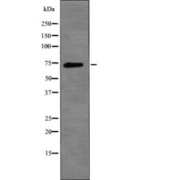 Western blot - L-plastin (Phospho-Ser5) Antibody from Signalway Antibody (12455) - Antibodies.com