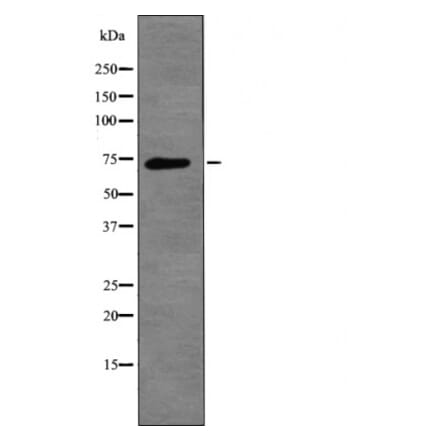 Western blot - L-plastin (Phospho-Ser5) Antibody from Signalway Antibody (12455) - Antibodies.com