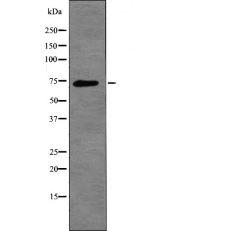 Western blot - L-plastin (Phospho-Ser5) Antibody from Signalway Antibody (12455) - Antibodies.com