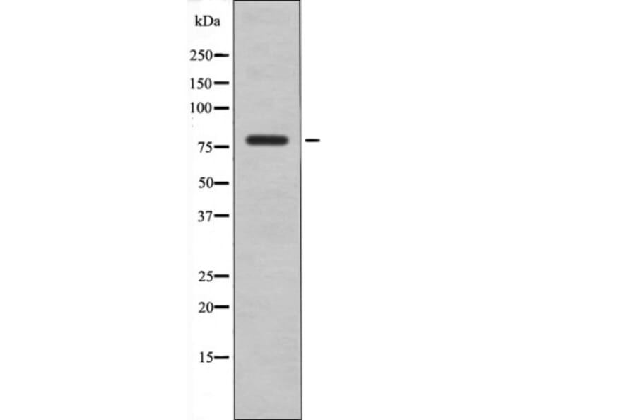 Western blot - eIF2B-ε (Phospho-Ser540) Antibody from Signalway Antibody (12543) - Antibodies.com