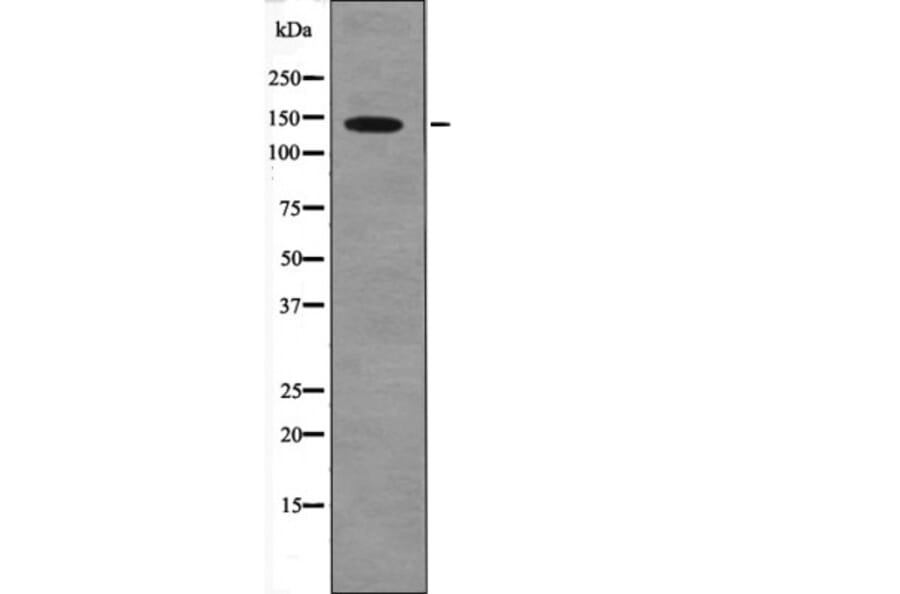 Western blot - PDGFRa (Phospho-Tyr1018) Antibody from Signalway Antibody (12560) - Antibodies.com
