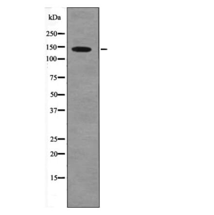 Western blot - PDGFRa (Phospho-Tyr1018) Antibody from Signalway Antibody (12560) - Antibodies.com