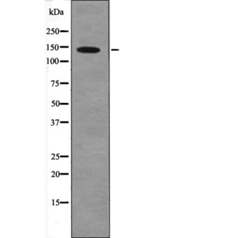 Western blot - PDGFRa (Phospho-Tyr1018) Antibody from Signalway Antibody (12560) - Antibodies.com