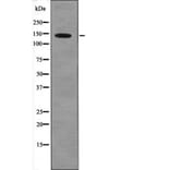 Western blot - PDGFRa (Phospho-Tyr1018) Antibody from Signalway Antibody (12560) - Antibodies.com