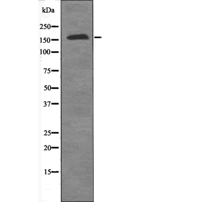 Western blot - PPARBP (Phospho-Thr1032) Antibody from Signalway Antibody (12627) - Antibodies.com