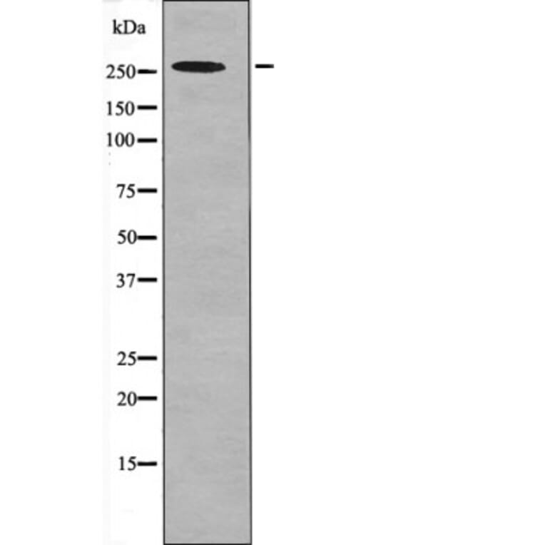 Western blot - POLR2A (Phospho-Ser1616) Antibody from Signalway Antibody (12664) - Antibodies.com