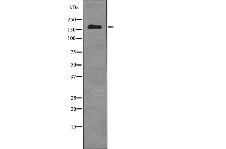 Western blot - TOPBP1 (Phospho-Ser1159) Antibody from Signalway Antibody (12786) - Antibodies.com