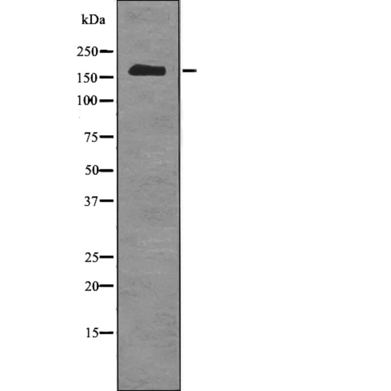 Western blot - TOPBP1 (Phospho-Ser1159) Antibody from Signalway Antibody (12786) - Antibodies.com