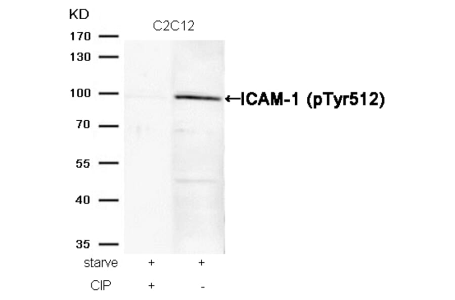 Western blot - ICAM-1 (Phospho-Tyr512) Antibody from Signalway Antibody (11083) - Antibodies.com