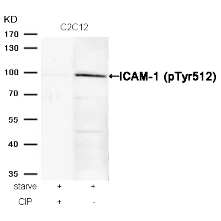Western blot - ICAM-1 (Phospho-Tyr512) Antibody from Signalway Antibody (11083) - Antibodies.com