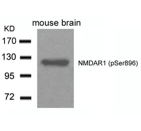Western blot - NMDAR1 (Phospho-Ser896) Antibody from Signalway Antibody (11104) - Antibodies.com