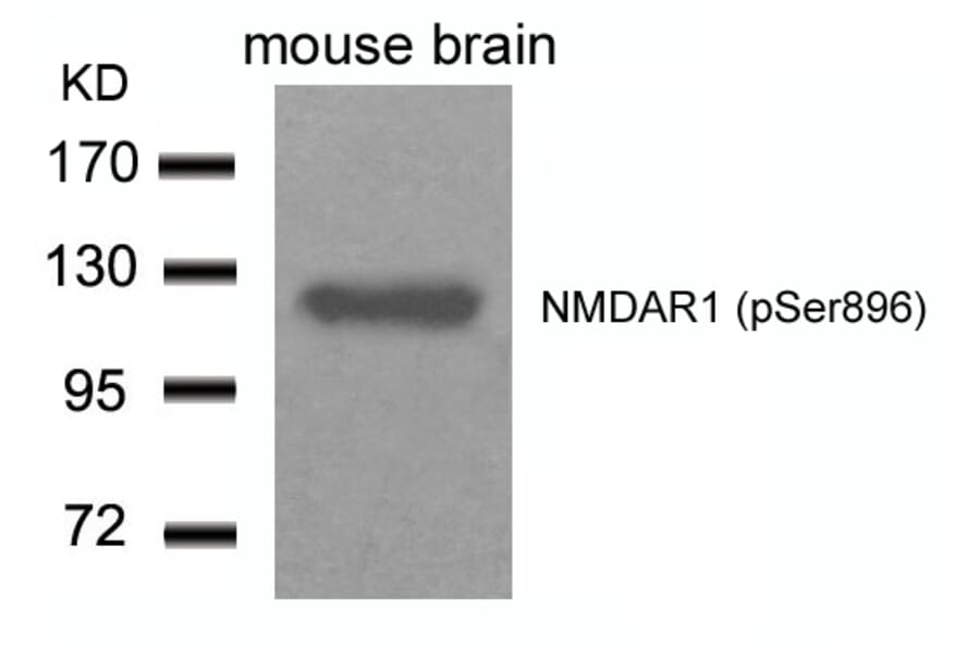 Western blot - NMDAR1 (Phospho-Ser896) Antibody from Signalway Antibody (11104) - Antibodies.com