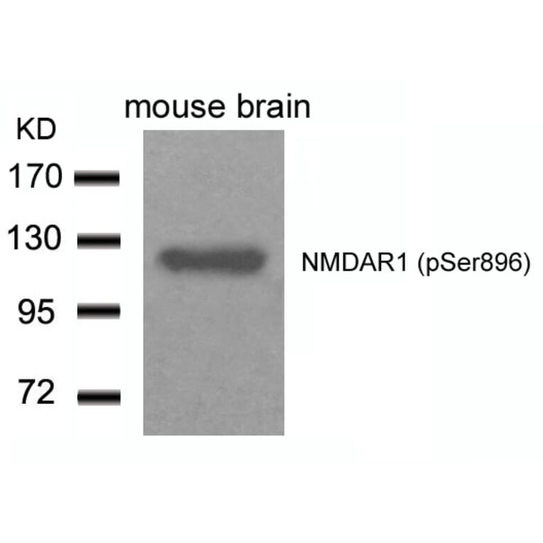 Western blot - NMDAR1 (Phospho-Ser896) Antibody from Signalway Antibody (11104) - Antibodies.com