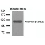 Western blot - NMDAR1 (Phospho-Ser896) Antibody from Signalway Antibody (11104) - Antibodies.com