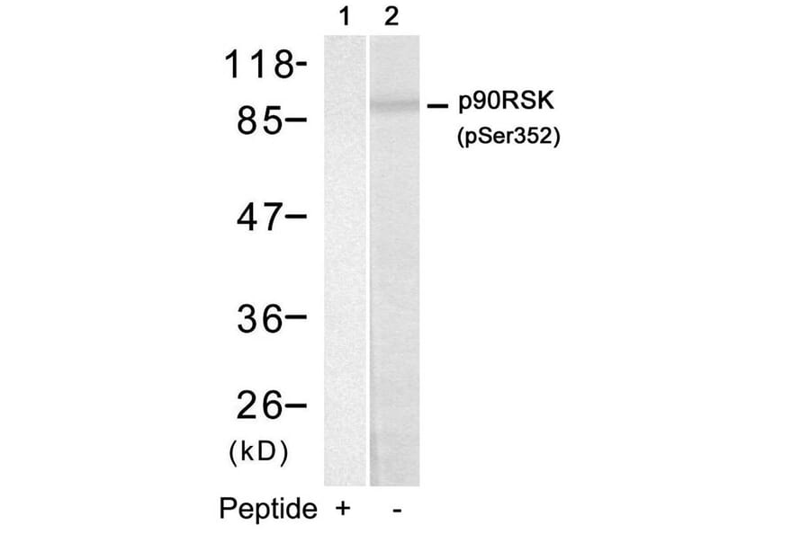 Western blot - p90RSK (Phospho-Ser352) Antibody from Signalway Antibody (11113) - Antibodies.com