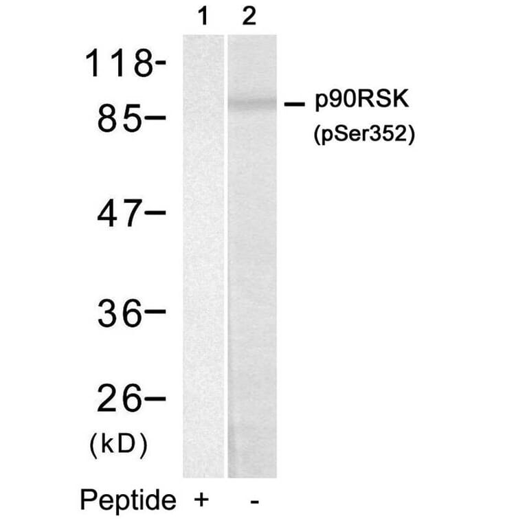 Western blot - p90RSK (Phospho-Ser352) Antibody from Signalway Antibody (11113) - Antibodies.com