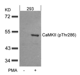 Western blot - CaMKII (Phospho-Thr286) Antibody from Signalway Antibody (11287) - Antibodies.com