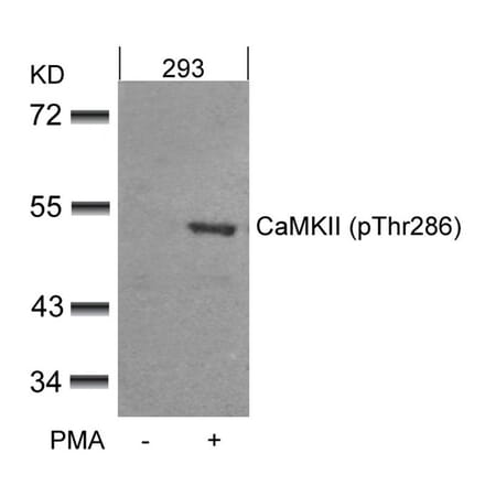 Western blot - CaMKII (Phospho-Thr286) Antibody from Signalway Antibody (11287) - Antibodies.com