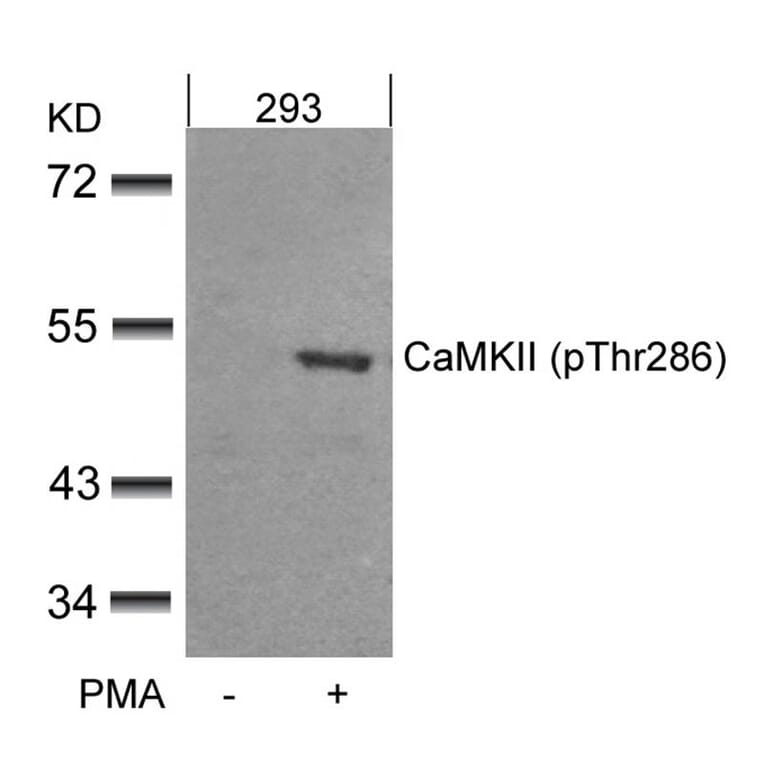 Western blot - CaMKII (Phospho-Thr286) Antibody from Signalway Antibody (11287) - Antibodies.com