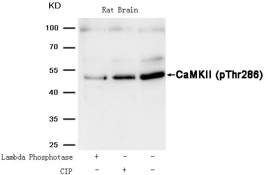 Anti-CaMKII (Phospho-Thr286) Antibody (A50881) | Antibodies.com