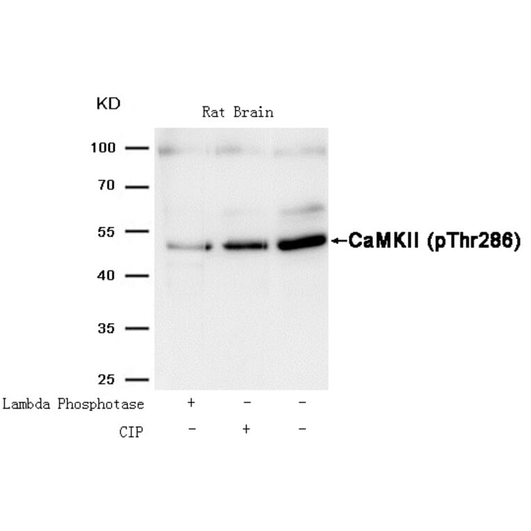 Western blot - CaMKII (Phospho-Thr286) Antibody from Signalway Antibody (11287) - Antibodies.com