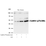 Western blot - CaMKII (Phospho-Thr286) Antibody from Signalway Antibody (11287) - Antibodies.com