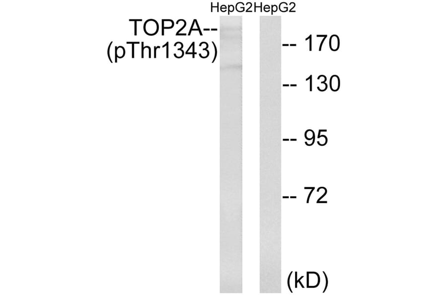 Western blot - TOP2A (Phospho-Thr1343) Antibody from Signalway Antibody (11763) - Antibodies.com