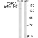 Western blot - TOP2A (Phospho-Thr1343) Antibody from Signalway Antibody (11763) - Antibodies.com