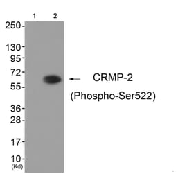 Western blot - CRMP-2 (Phospho-Ser522) Antibody from Signalway Antibody (11841) - Antibodies.com