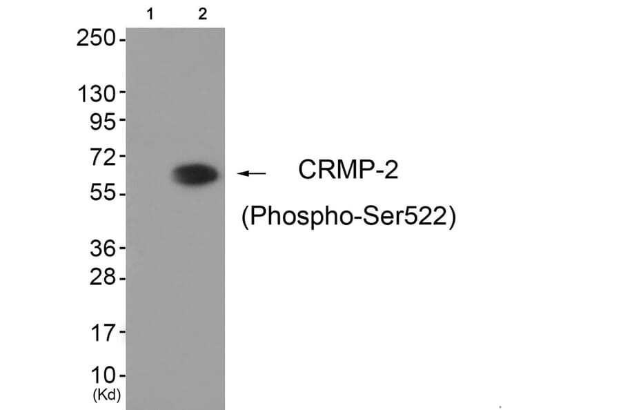 Western blot - CRMP-2 (Phospho-Ser522) Antibody from Signalway Antibody (11841) - Antibodies.com