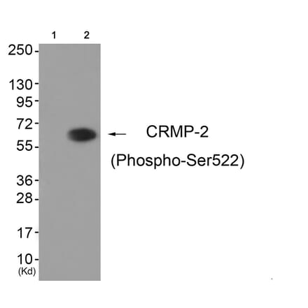 Western blot - CRMP-2 (Phospho-Ser522) Antibody from Signalway Antibody (11841) - Antibodies.com
