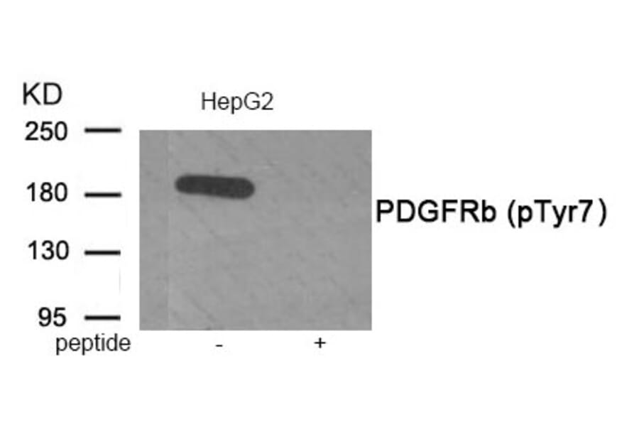 Western blot - PDGFRb (Phospho-Tyr771) Antibody from Signalway Antibody (11907) - Antibodies.com