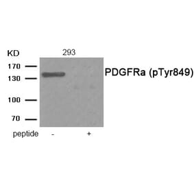 Western blot - PDGFRa (Phospho-Tyr849) Antibody from Signalway Antibody (11912) - Antibodies.com