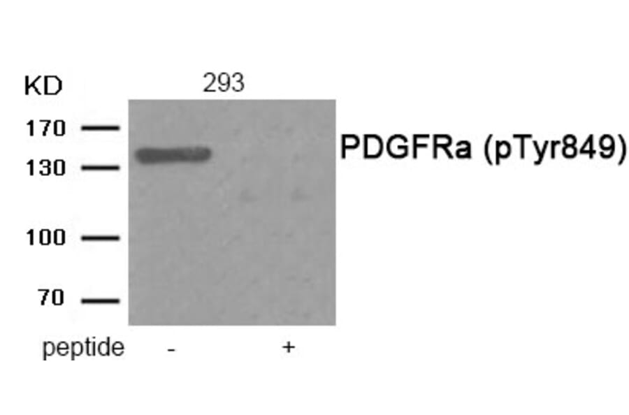 Western blot - PDGFRa (Phospho-Tyr849) Antibody from Signalway Antibody (11912) - Antibodies.com