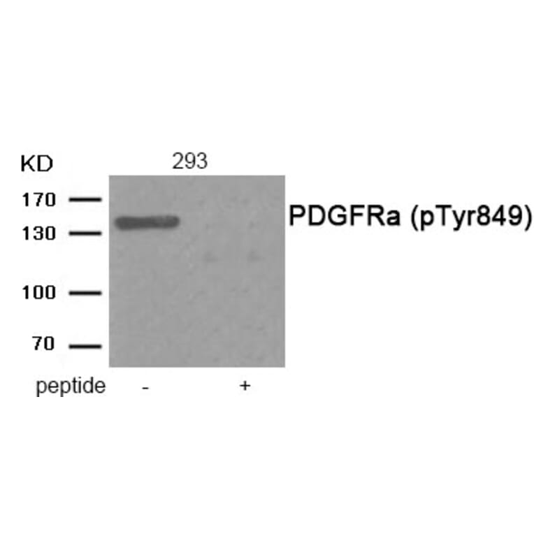 Western blot - PDGFRa (Phospho-Tyr849) Antibody from Signalway Antibody (11912) - Antibodies.com