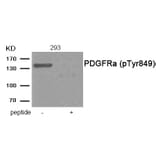 Western blot - PDGFRa (Phospho-Tyr849) Antibody from Signalway Antibody (11912) - Antibodies.com