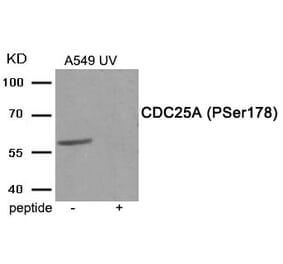 Western blot - CDC25A (Phospho-Ser178) Antibody from Signalway Antibody (11948) - Antibodies.com