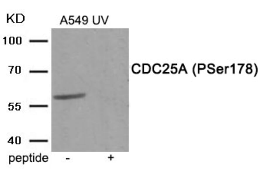 Western blot - CDC25A (Phospho-Ser178) Antibody from Signalway Antibody (11948) - Antibodies.com