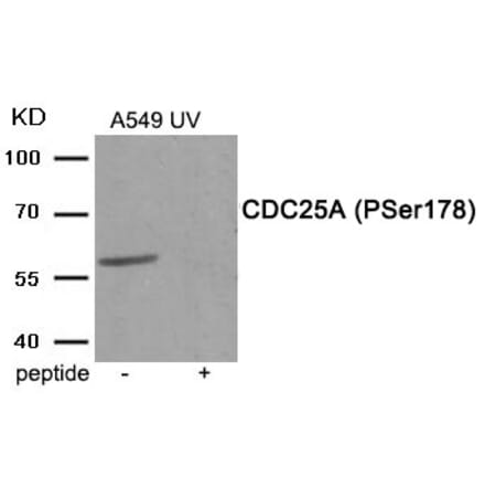 Western blot - CDC25A (Phospho-Ser178) Antibody from Signalway Antibody (11948) - Antibodies.com