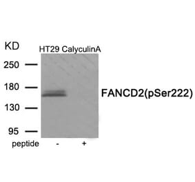 Western blot - FANCD2 (Phospho-Ser222) Antibody from Signalway Antibody (11965) - Antibodies.com