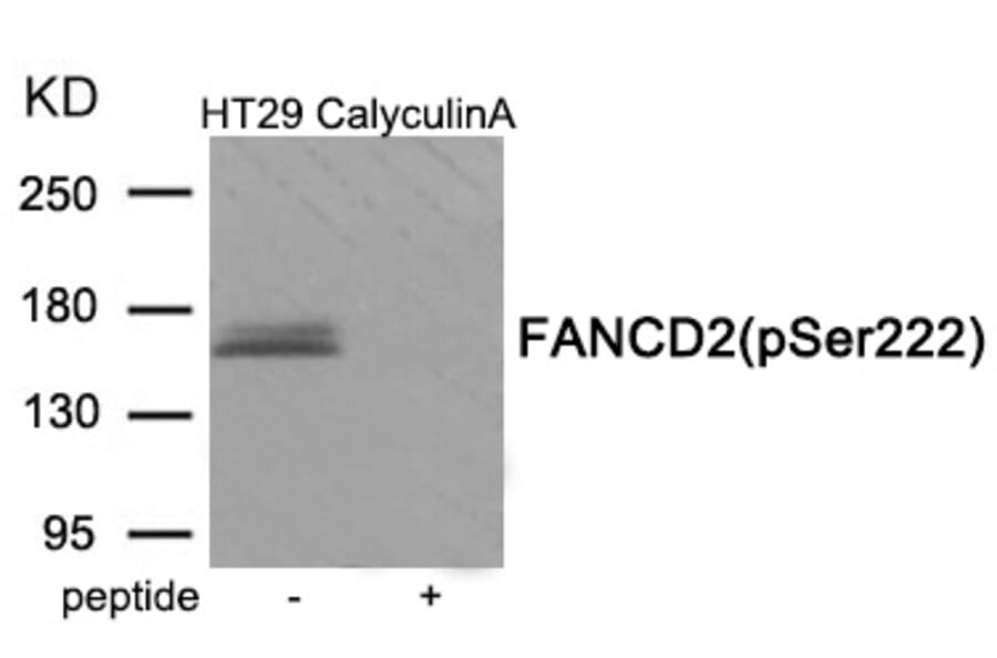 Western blot - FANCD2 (Phospho-Ser222) Antibody from Signalway Antibody (11965) - Antibodies.com