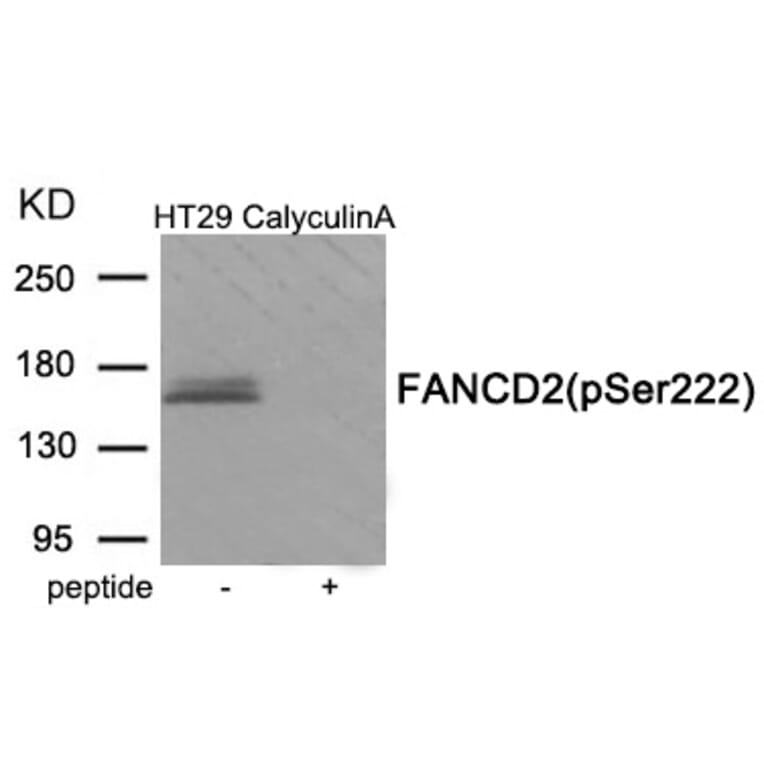 Western blot - FANCD2 (Phospho-Ser222) Antibody from Signalway Antibody (11965) - Antibodies.com