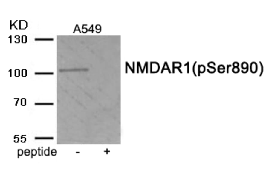 Western blot - NMDAR1 (Phospho-Ser890) Antibody from Signalway Antibody (11979) - Antibodies.com