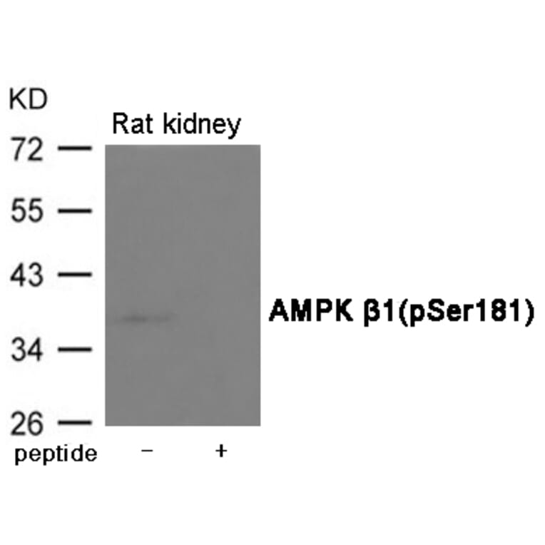 Western blot - AMPK β1 (Phospho-Ser181) Antibody from Signalway Antibody (12071) - Antibodies.com