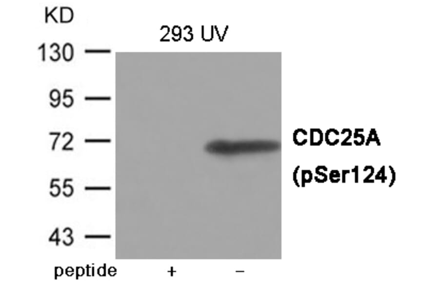 Western blot - CDC25A (Phospho-Ser124) Antibody from Signalway Antibody (12073) - Antibodies.com