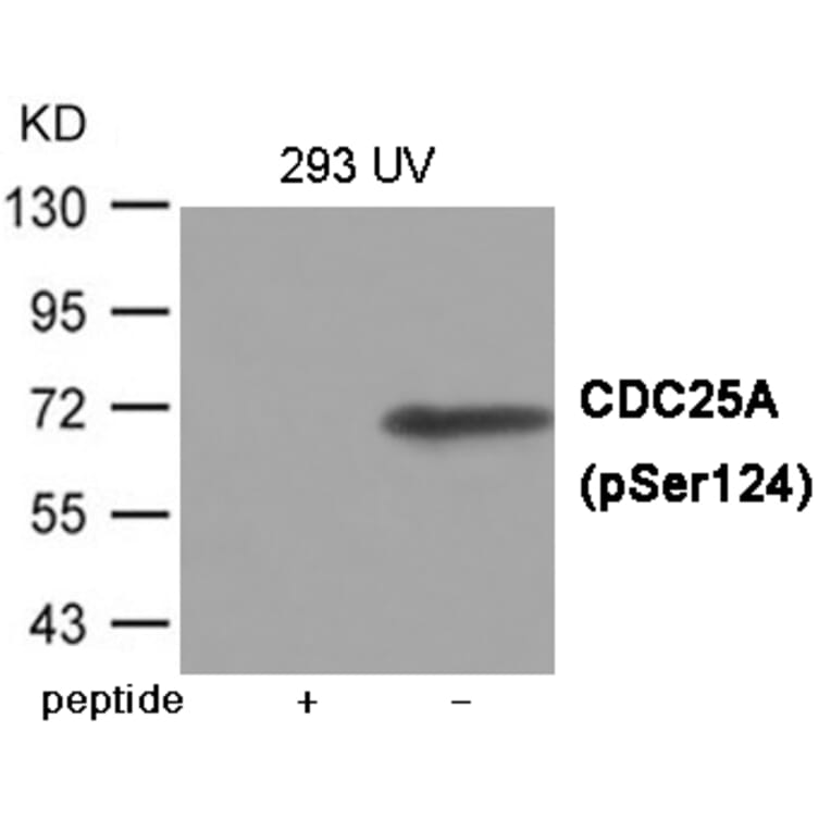 Western blot - CDC25A (Phospho-Ser124) Antibody from Signalway Antibody (12073) - Antibodies.com
