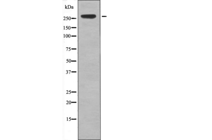 Western blot - IGF2R (Phospho-Ser2484) Antibody from Signalway Antibody (12443) - Antibodies.com