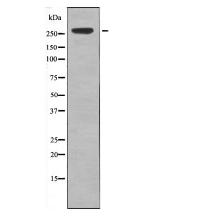 Western blot - IGF2R (Phospho-Ser2484) Antibody from Signalway Antibody (12443) - Antibodies.com